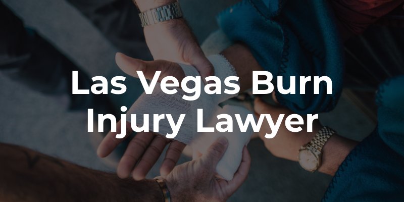 Las Vegas Burn Injury Lawyer