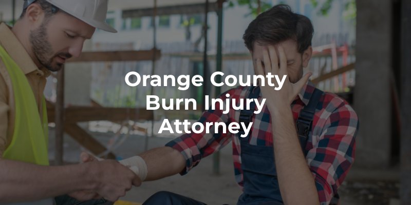 Orange County Burn Injury Attorney