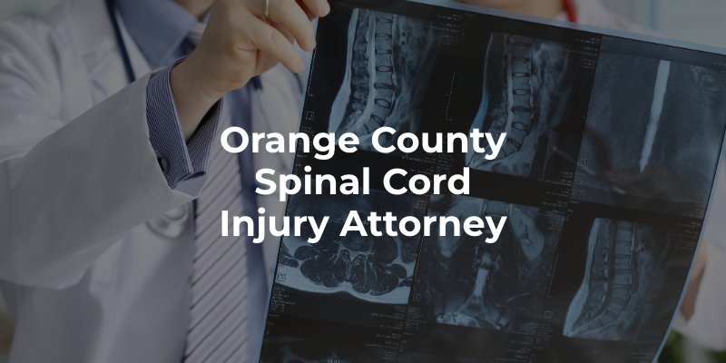 Orange County Spinal Cord Injury Attorney